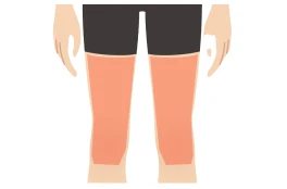 両ひざ上（太もも）料金