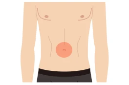 へそ周り（へそ毛）料金