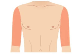 両ひじ上（二の腕）料金