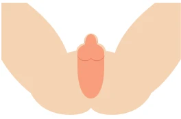 Iライン脱毛（陰嚢周辺）料金