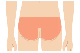 おしり脱毛（お尻）料金