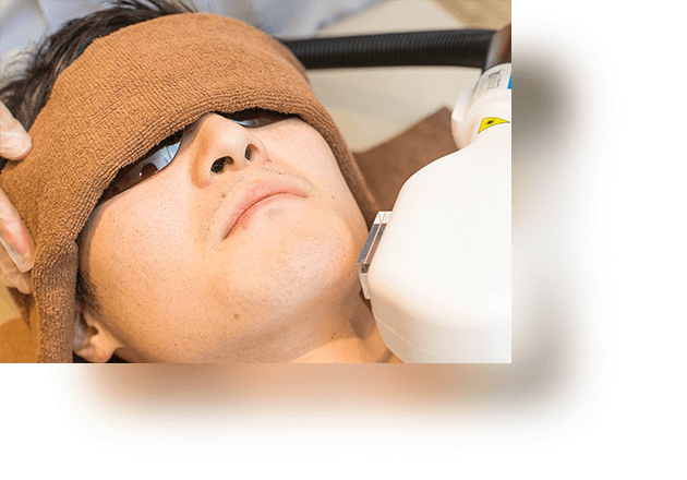 メンズ脱⽑施術